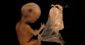 How Moral Are You? Planned Parenthood’s Illegal Sale of Aborted Tissue, Revealed!