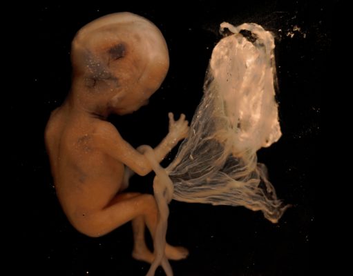 How Moral Are You? Planned Parenthood’s Illegal Sale of Aborted Tissue, Revealed!