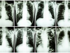 3 Surprising Dangers of Aluminum Foil (And What to Use Instead)