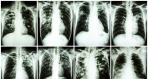 3 Surprising Dangers of Aluminum Foil (And What to Use Instead)